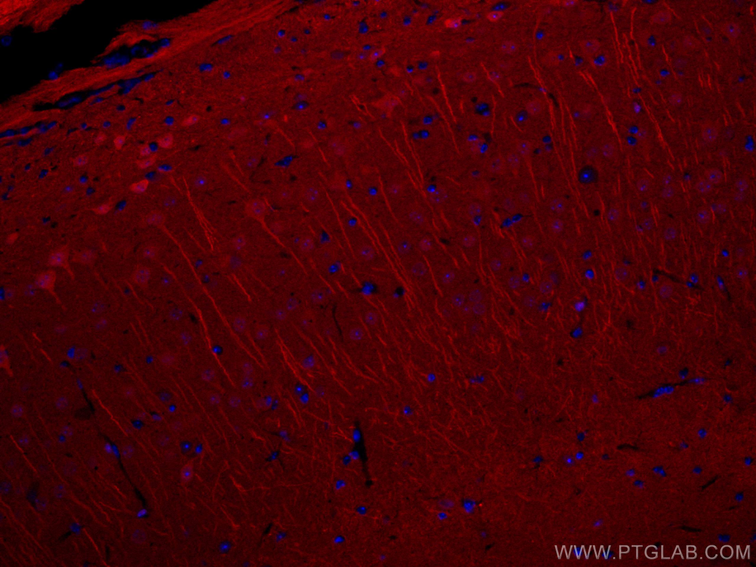 Immunofluorescence (IF) / fluorescent staining of mouse brain tissue using CoraLite®594-conjugated UCHL1/PGP9.5 Polyclonal an (CL594-14730)