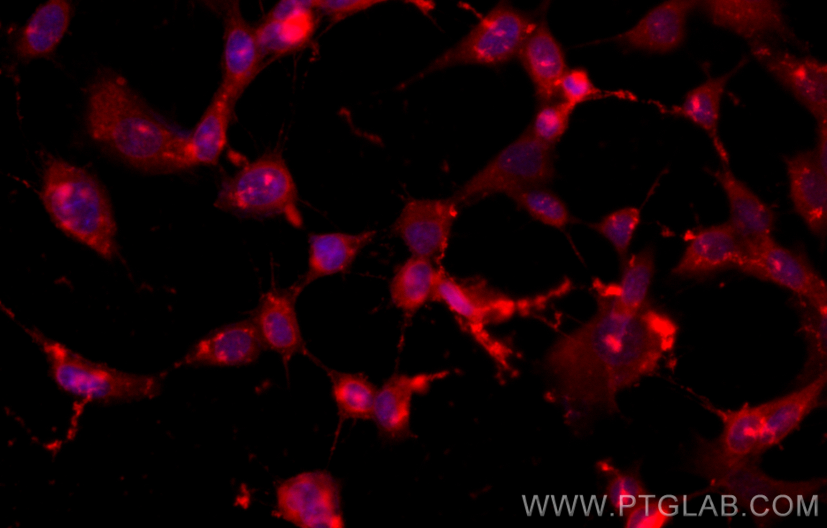 Immunofluorescence (IF) / fluorescent staining of SH-SY5Y cells using CoraLite®594-conjugated UCHL1/PGP9.5 Monoclonal an (CL594-66230)