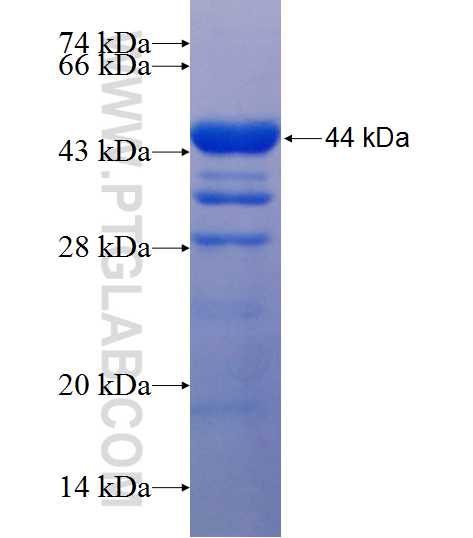 UCKL1 fusion protein Ag10929 SDS-PAGE