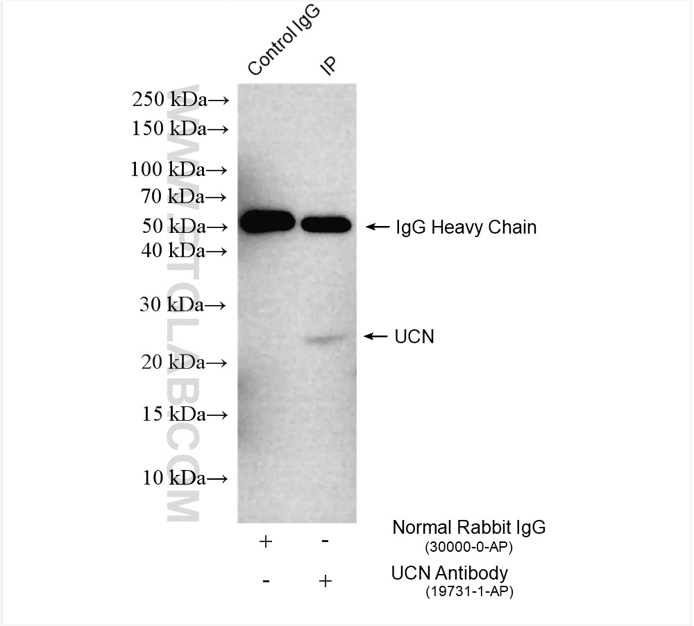 Immunoprecipitation (IP) experiment of mouse kidney tissue using Urocortin Polyclonal antibody (19731-1-AP)