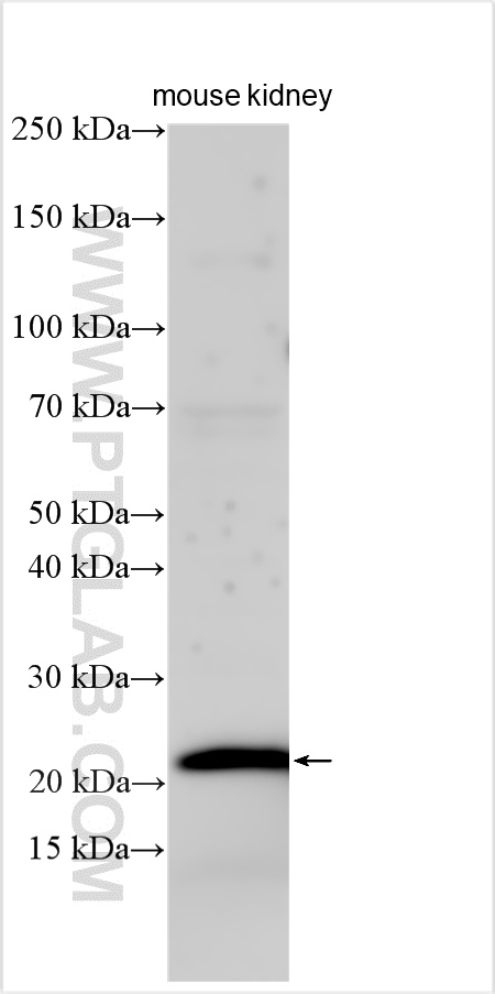 Western Blot (WB) analysis of various lysates using Urocortin Polyclonal antibody (19731-1-AP)