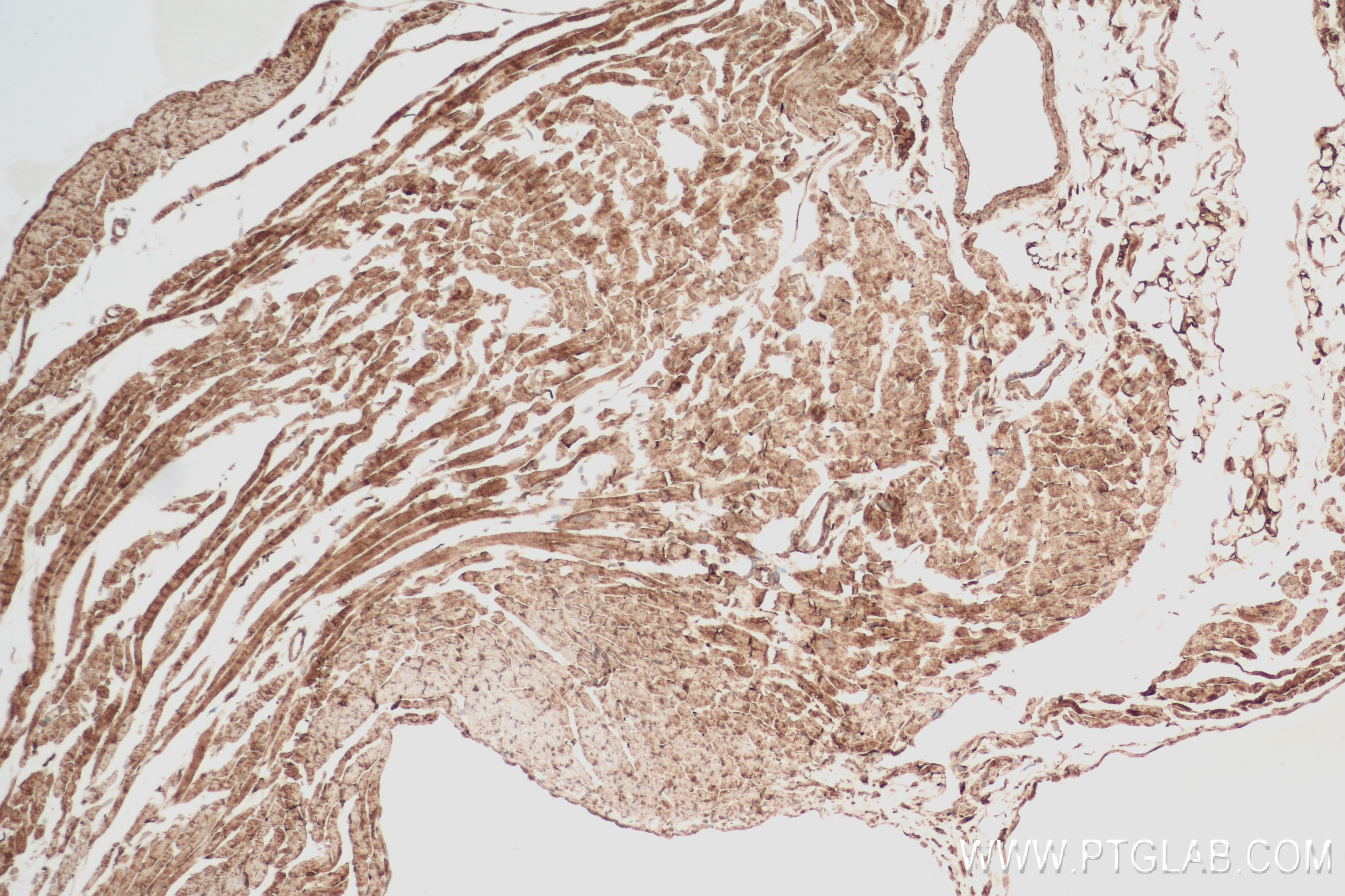 Immunohistochemistry (IHC) staining of mouse heart tissue using Urocortin Recombinant antibody (84380-1-RR)