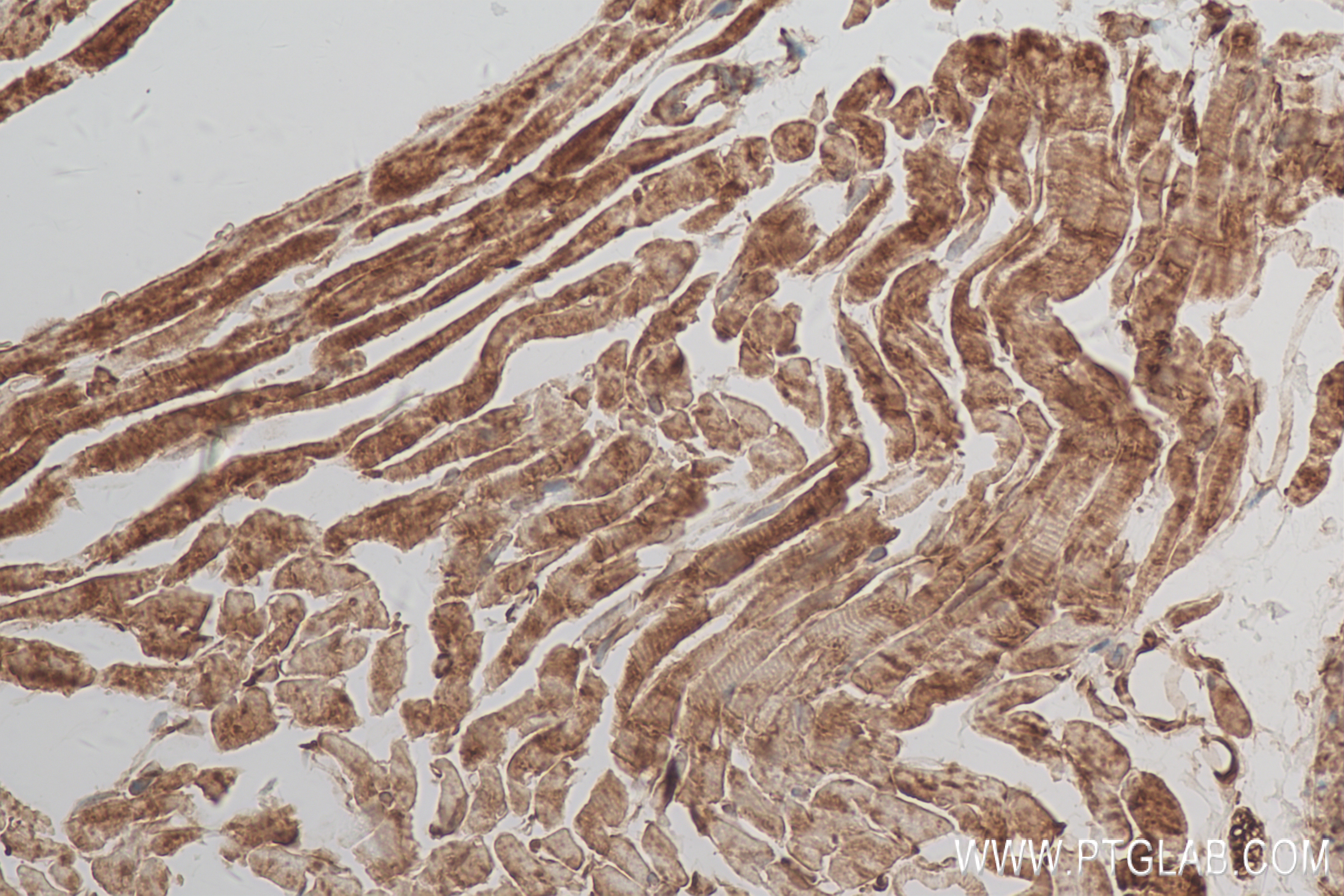 Immunohistochemistry (IHC) staining of mouse heart tissue using Urocortin Recombinant antibody (84380-1-RR)