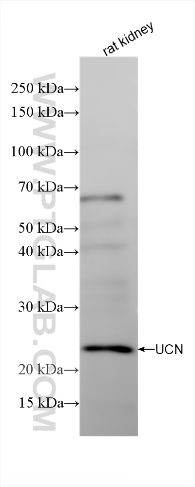 Urocortin