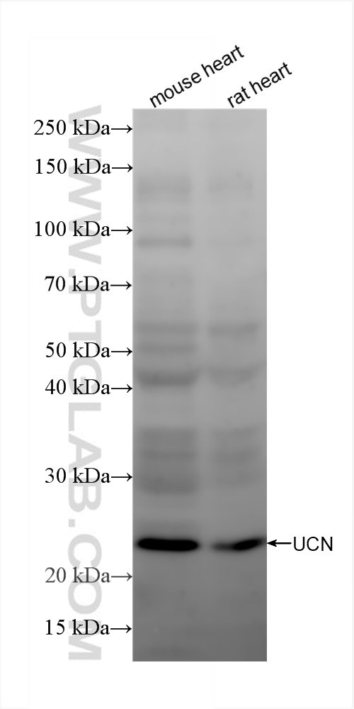 Western Blot (WB) analysis of various lysates using Urocortin Recombinant antibody (84380-1-RR)