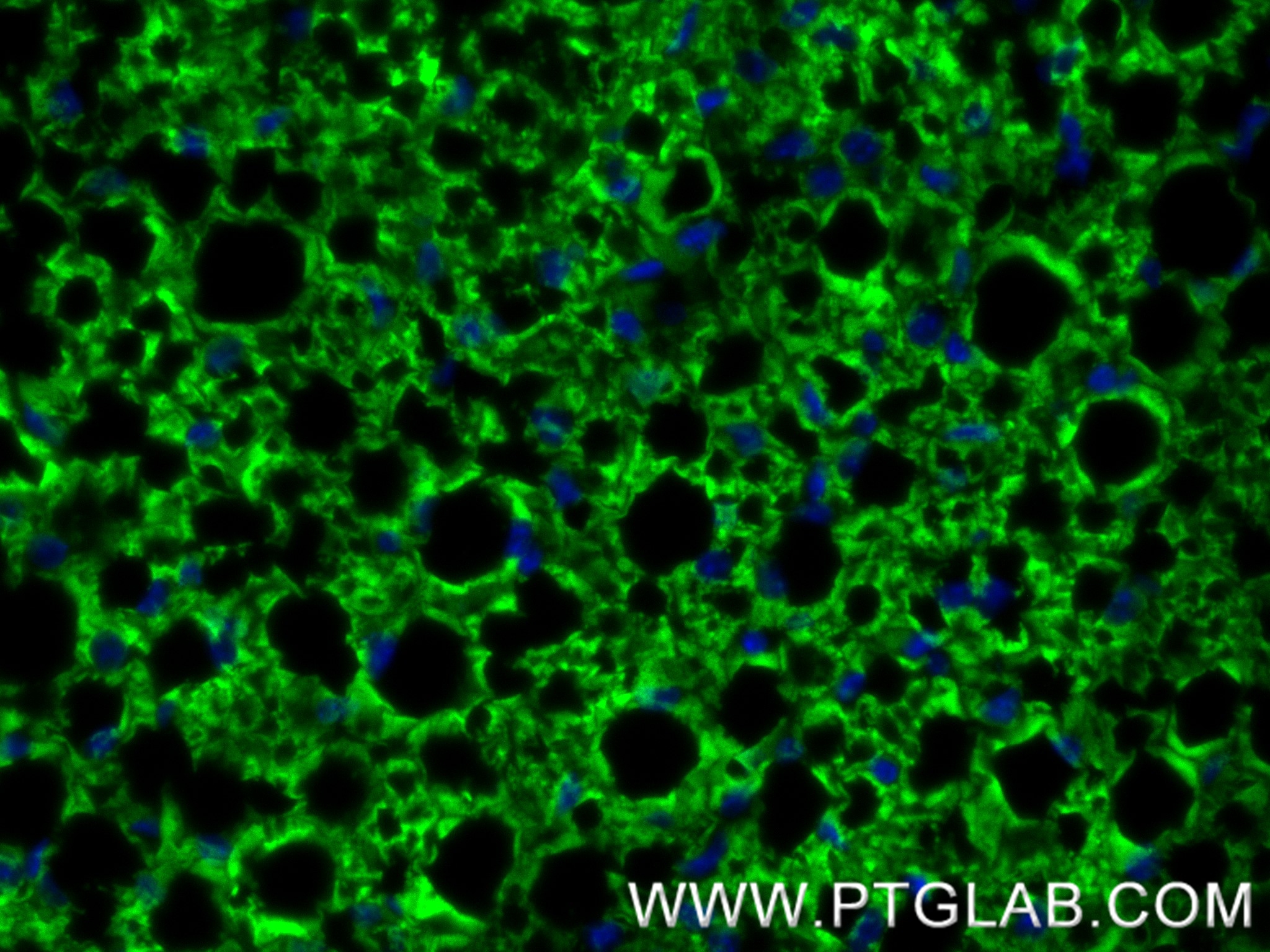 Immunofluorescence (IF) / fluorescent staining of mouse brown adipose tissue using UCP1 Recombinant antibody (83870-1-RR)