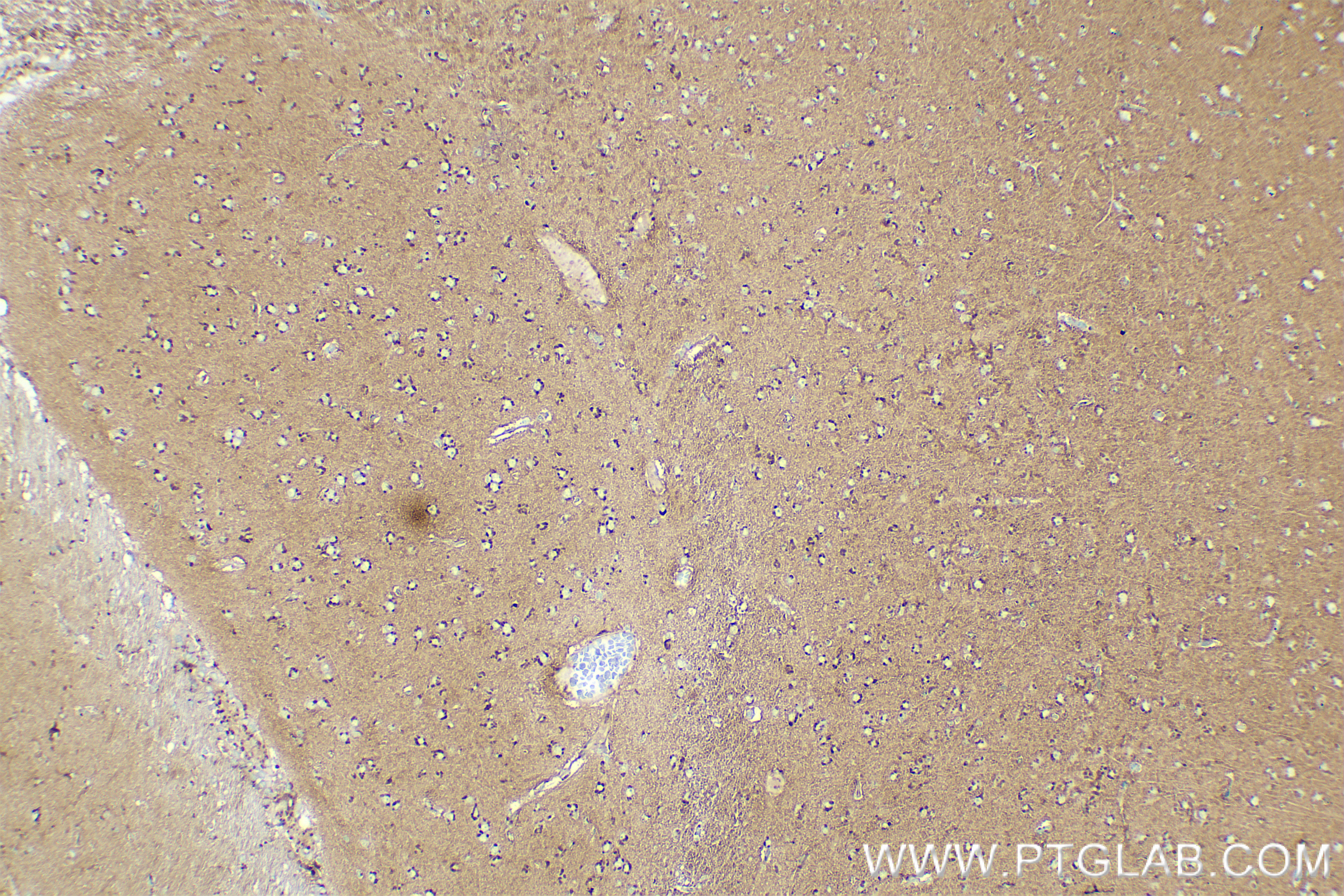 Immunohistochemistry (IHC) staining of rat brain tissue using UCP1 Recombinant antibody (83870-1-RR)