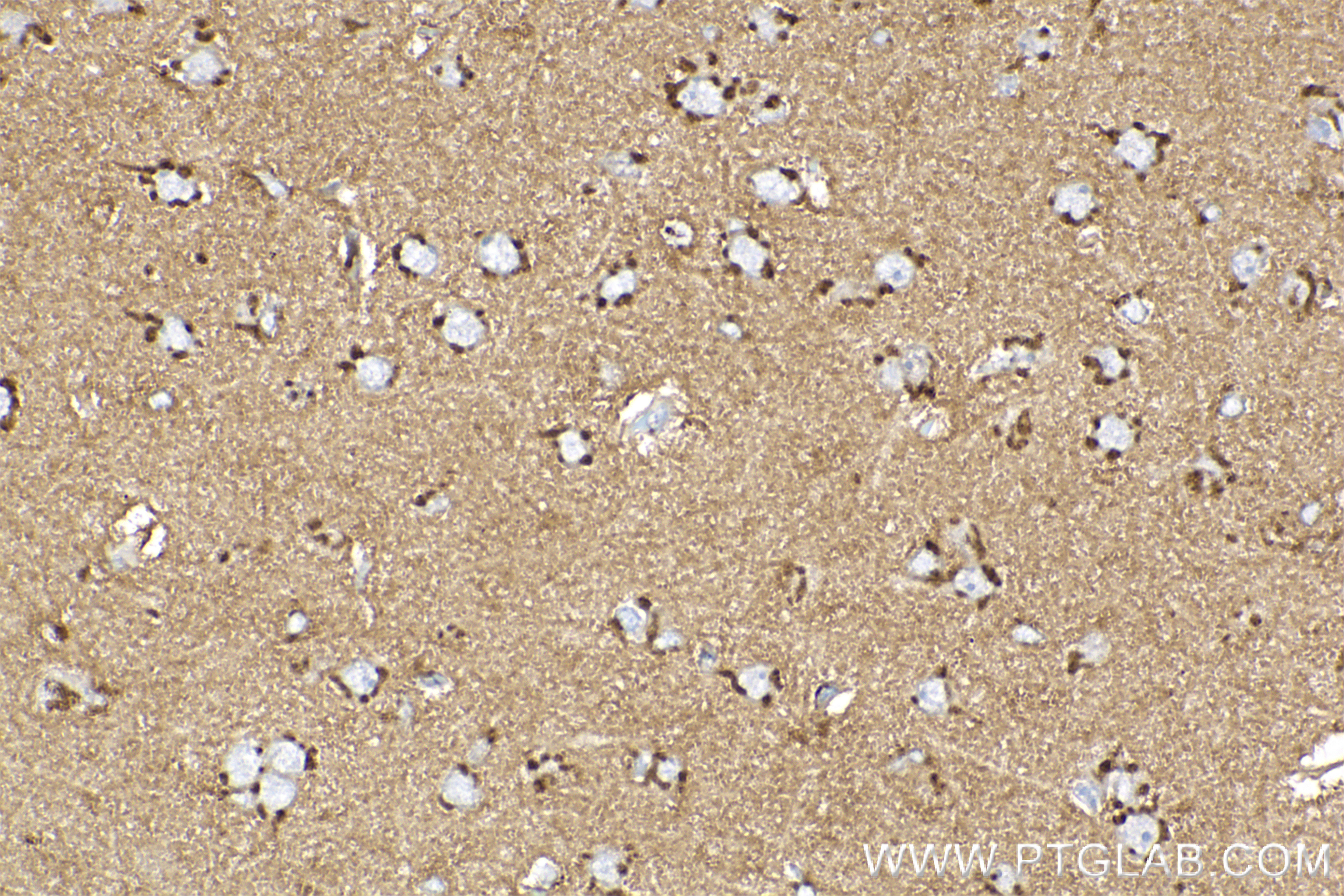 Immunohistochemistry (IHC) staining of rat brain tissue using UCP1 Recombinant antibody (83870-1-RR)