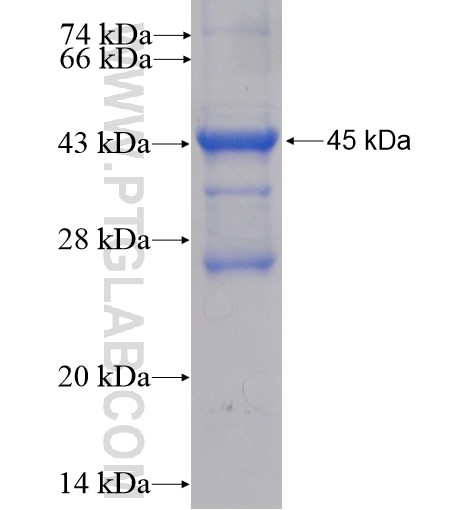 UFC1 fusion protein Ag8480 SDS-PAGE