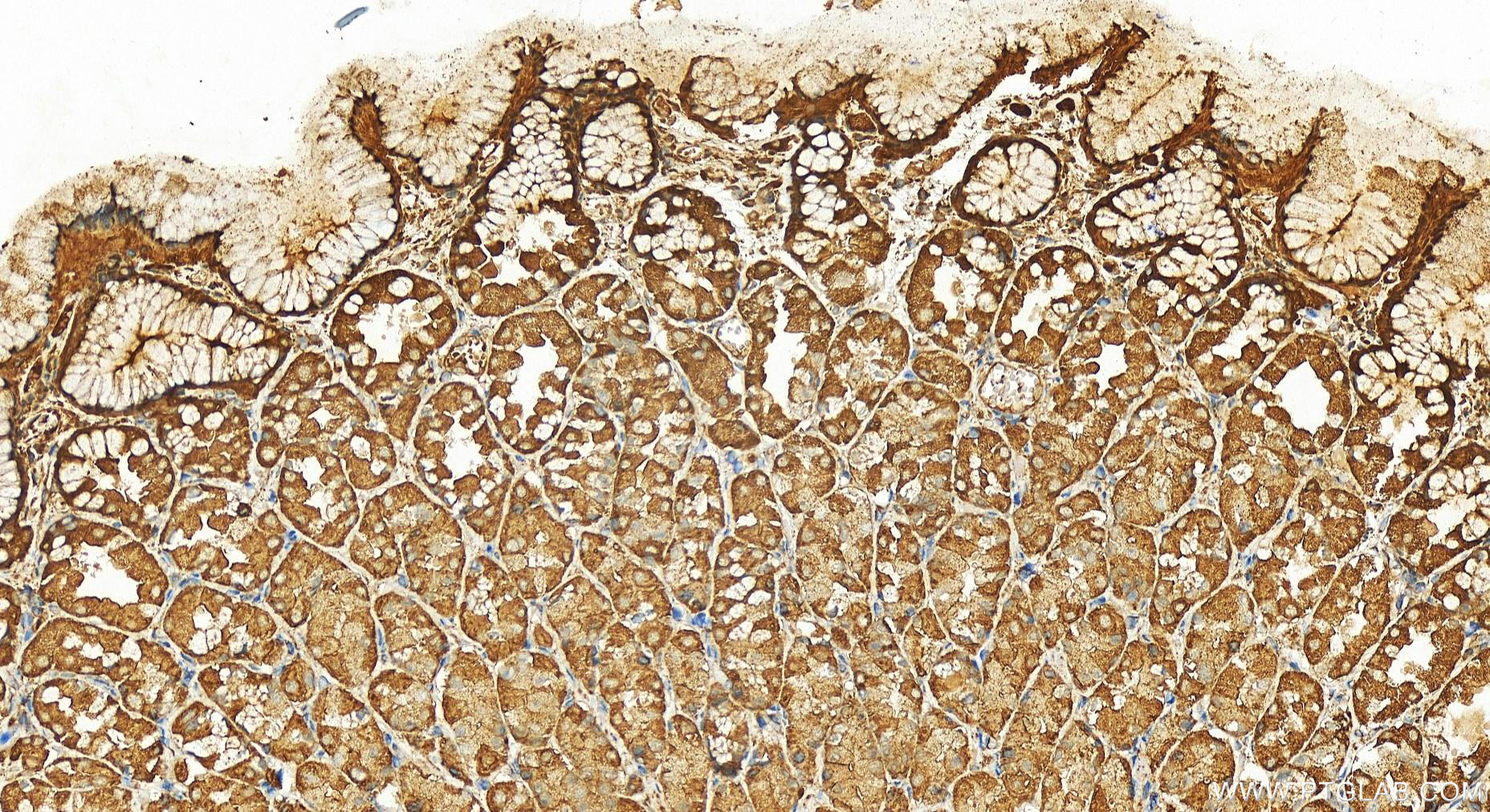 Immunohistochemistry (IHC) staining of human stomach tissue using UFD1L Polyclonal antibody (10615-1-AP)