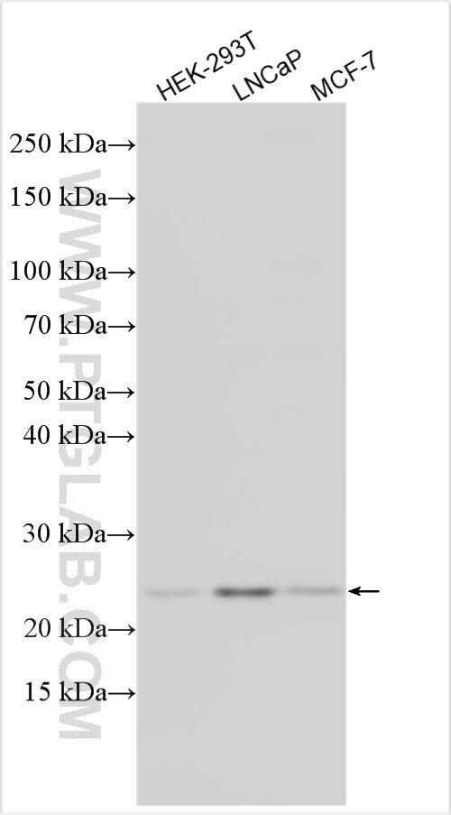 UFSP1