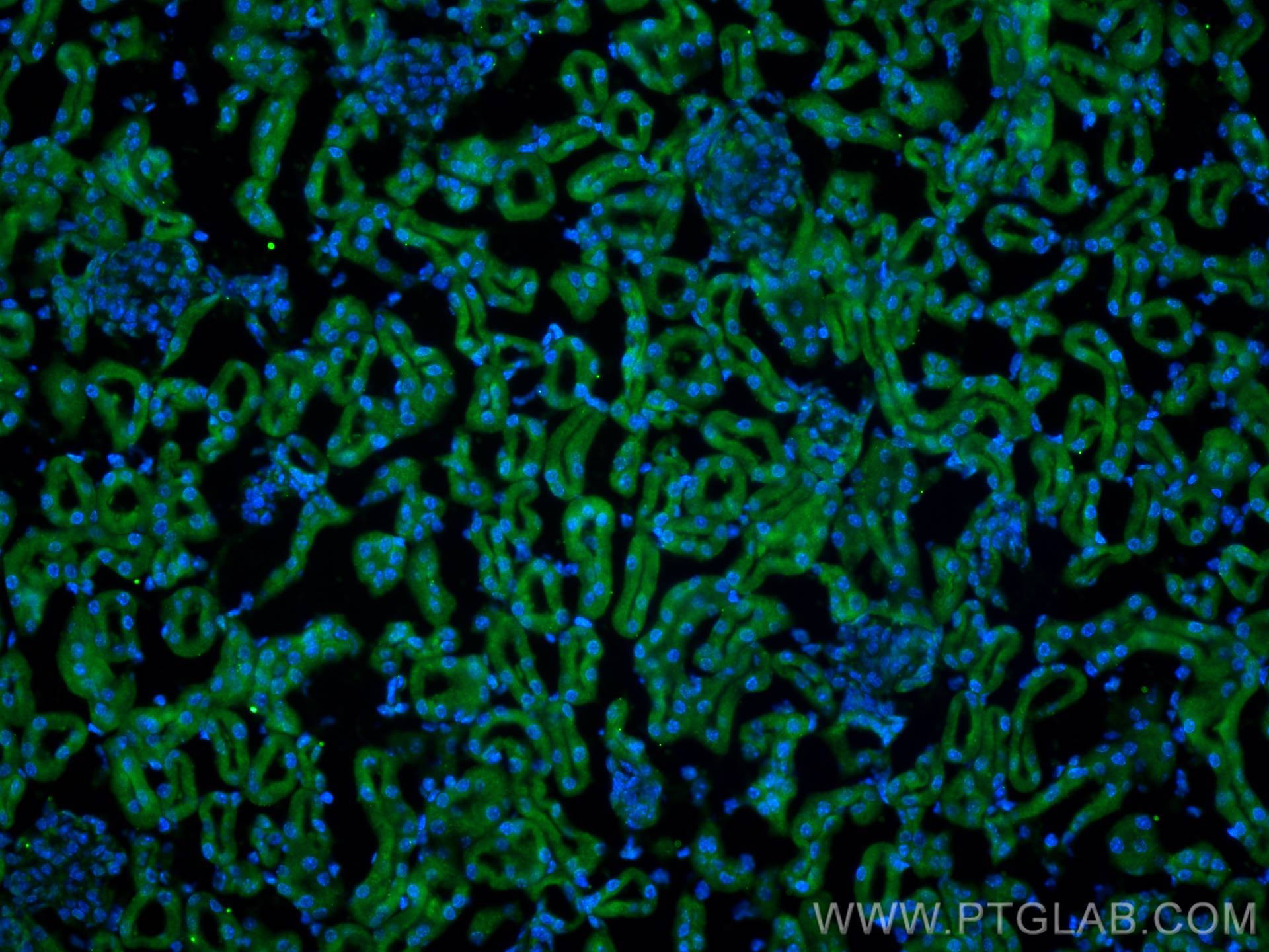 Immunofluorescence (IF) / fluorescent staining of mouse kidney tissue using UGCG Polyclonal antibody (12869-1-AP)