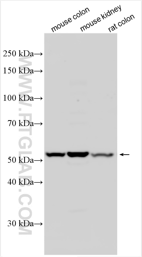 Western Blot (WB) analysis of various lysates using UGT3A1 Polyclonal antibody (17268-1-AP)