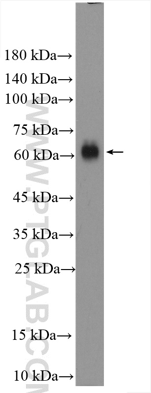 Western Blot (WB) analysis of rat brain tissue using UGT8 Polyclonal antibody (17982-1-AP)