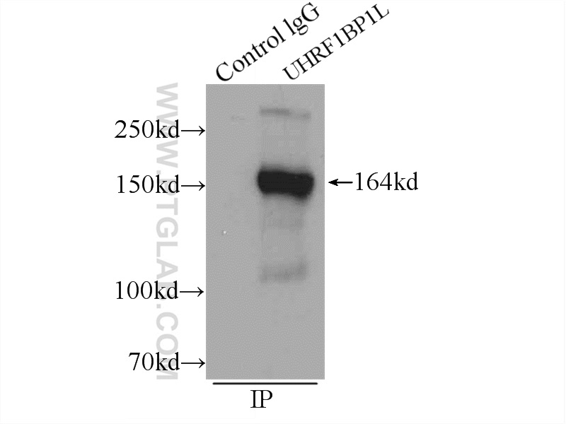 Immunoprecipitation (IP) experiment of mouse brain tissue using UHRF1BP1L Polyclonal antibody (25121-1-AP)