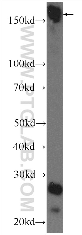 Western Blot (WB) analysis of mouse brain tissue using UHRF1BP1L Polyclonal antibody (25121-1-AP)