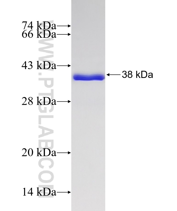 ULBP3 fusion protein Ag32424 SDS-PAGE