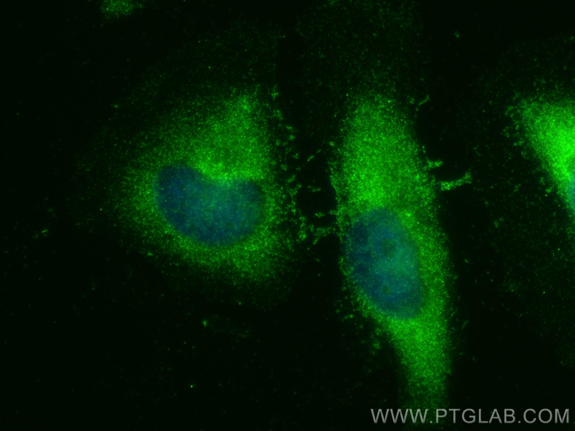 Immunofluorescence (IF) / fluorescent staining of HeLa cells using ULK1 Polyclonal antibody (27352-1-AP)