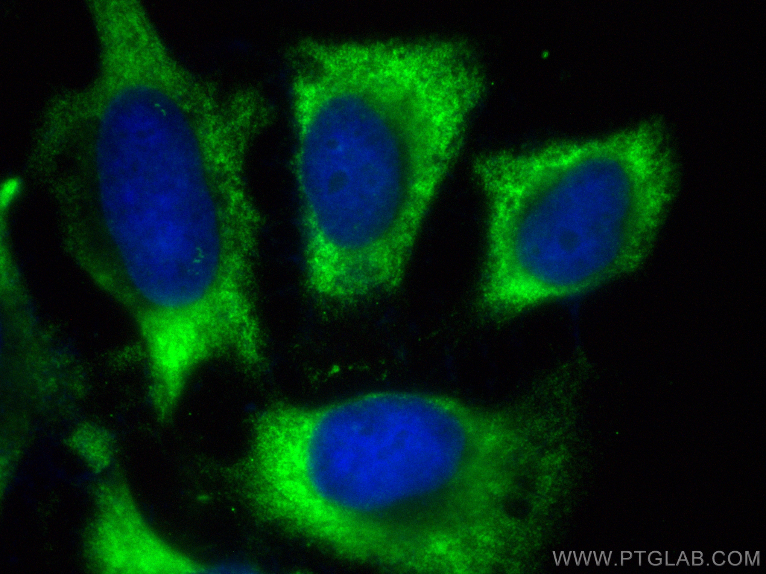 Immunofluorescence (IF) / fluorescent staining of HeLa cells using CoraLite® Plus 488-conjugated ULK1 Polyclonal anti (CL488-29005)