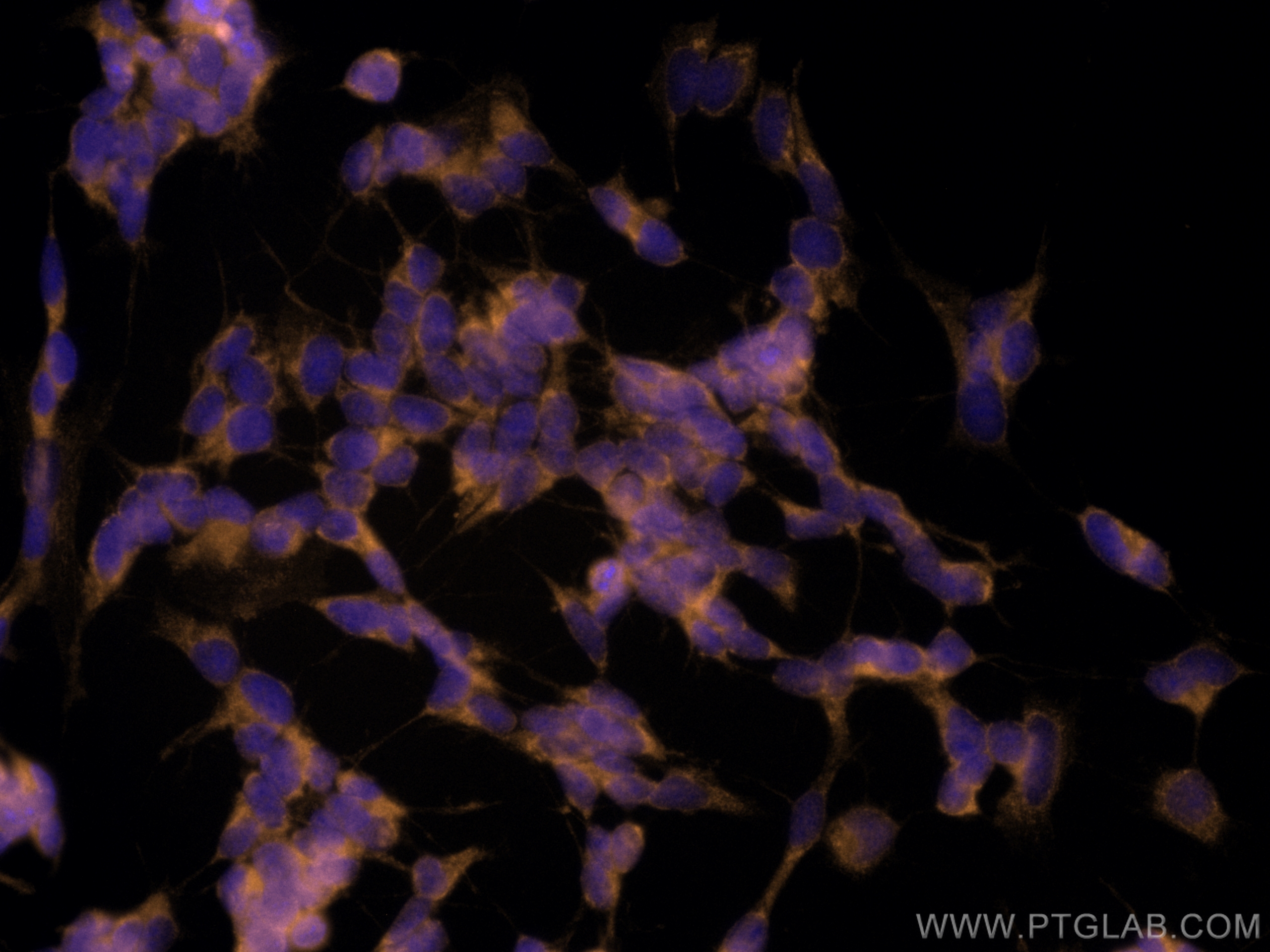 Immunofluorescence (IF) / fluorescent staining of SH-SY5Y cells using CoraLite®555-conjugated UNC13A Monoclonal antibody (CL555-68483)