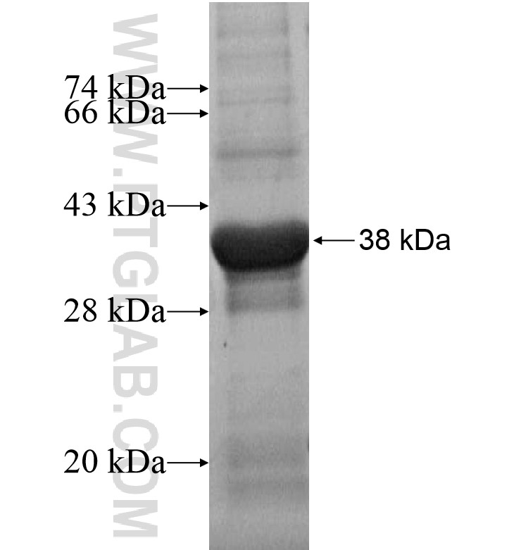 UNC5C fusion protein Ag16243 SDS-PAGE