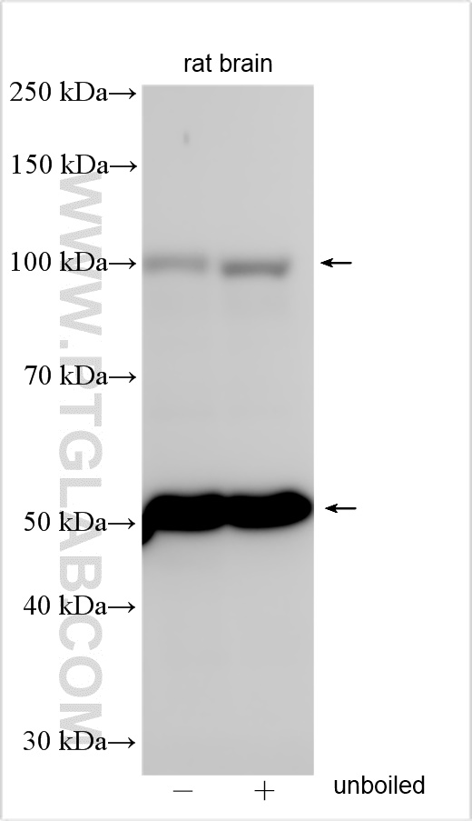 Western Blot (WB) analysis of various lysates using UNC5C-Specific Polyclonal antibody (20240-1-AP)