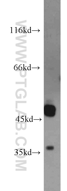 Western Blot (WB) analysis of HeLa cells using UNKL Polyclonal antibody (15000-1-AP)