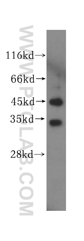 Western Blot (WB) analysis of HeLa cells using UNKL Polyclonal antibody (15000-1-AP)