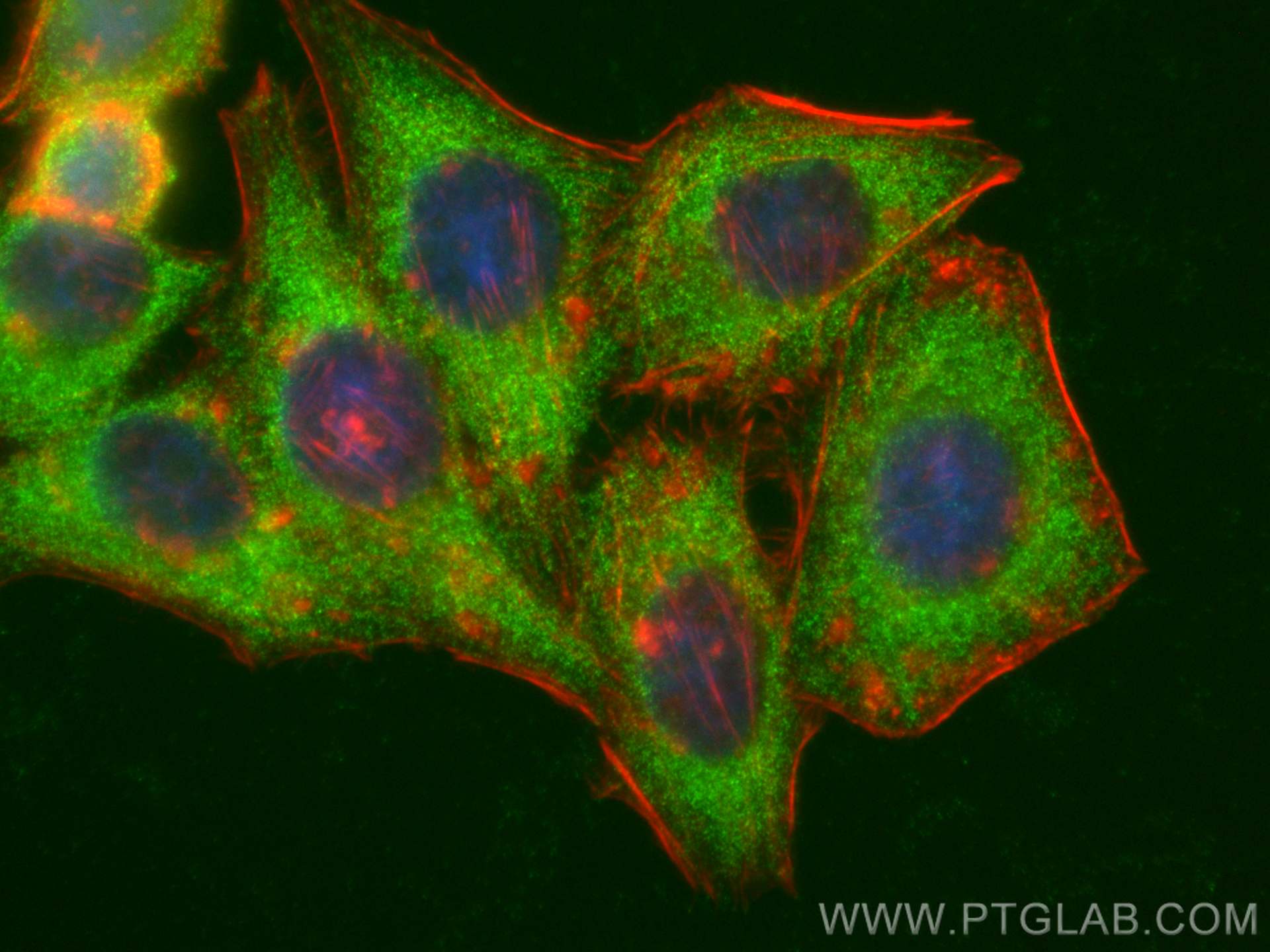 Immunofluorescence (IF) / fluorescent staining of HepG2 cells using UPF1 Polyclonal antibody (23379-1-AP)