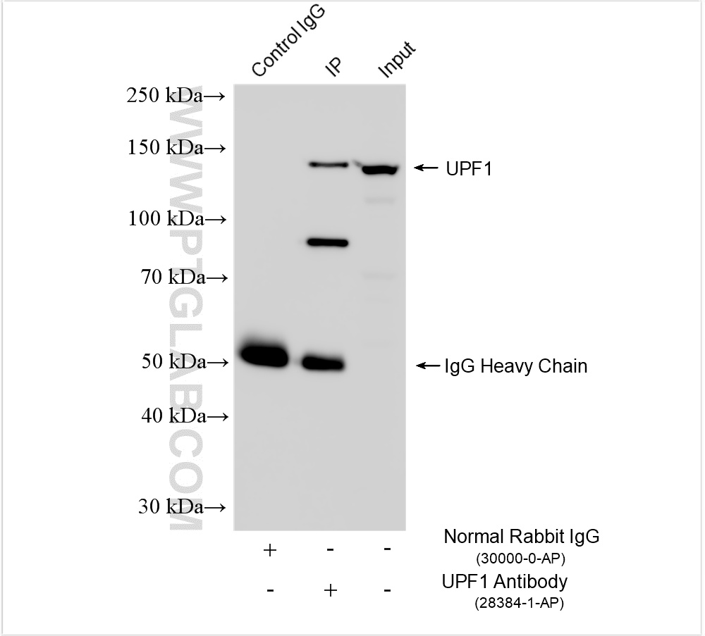 Immunoprecipitation (IP) experiment of HeLa cells using UPF1 Polyclonal antibody (28384-1-AP)