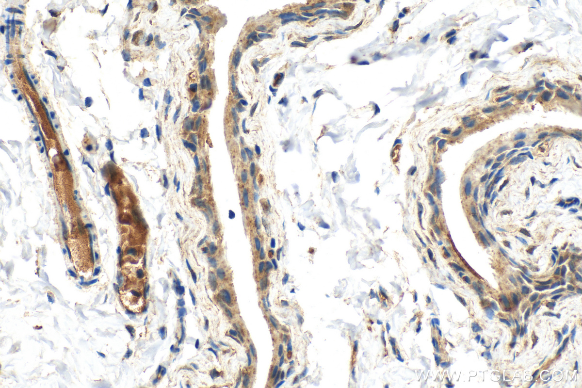 Immunohistochemistry (IHC) staining of mouse bladder tissue using UPK2 Polyclonal antibody (21149-1-AP)