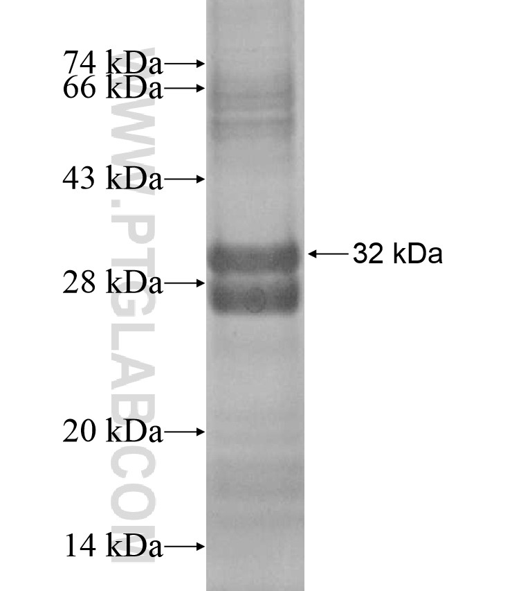 UPK2 fusion protein Ag17674 SDS-PAGE