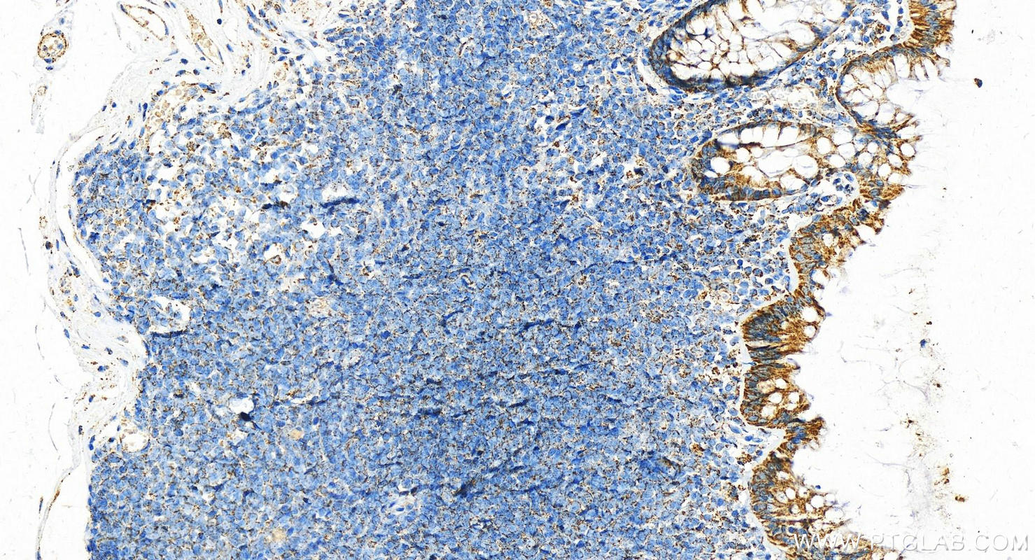 Immunohistochemistry (IHC) staining of human colon tissue using UQCRC1 Polyclonal antibody (21705-1-AP)