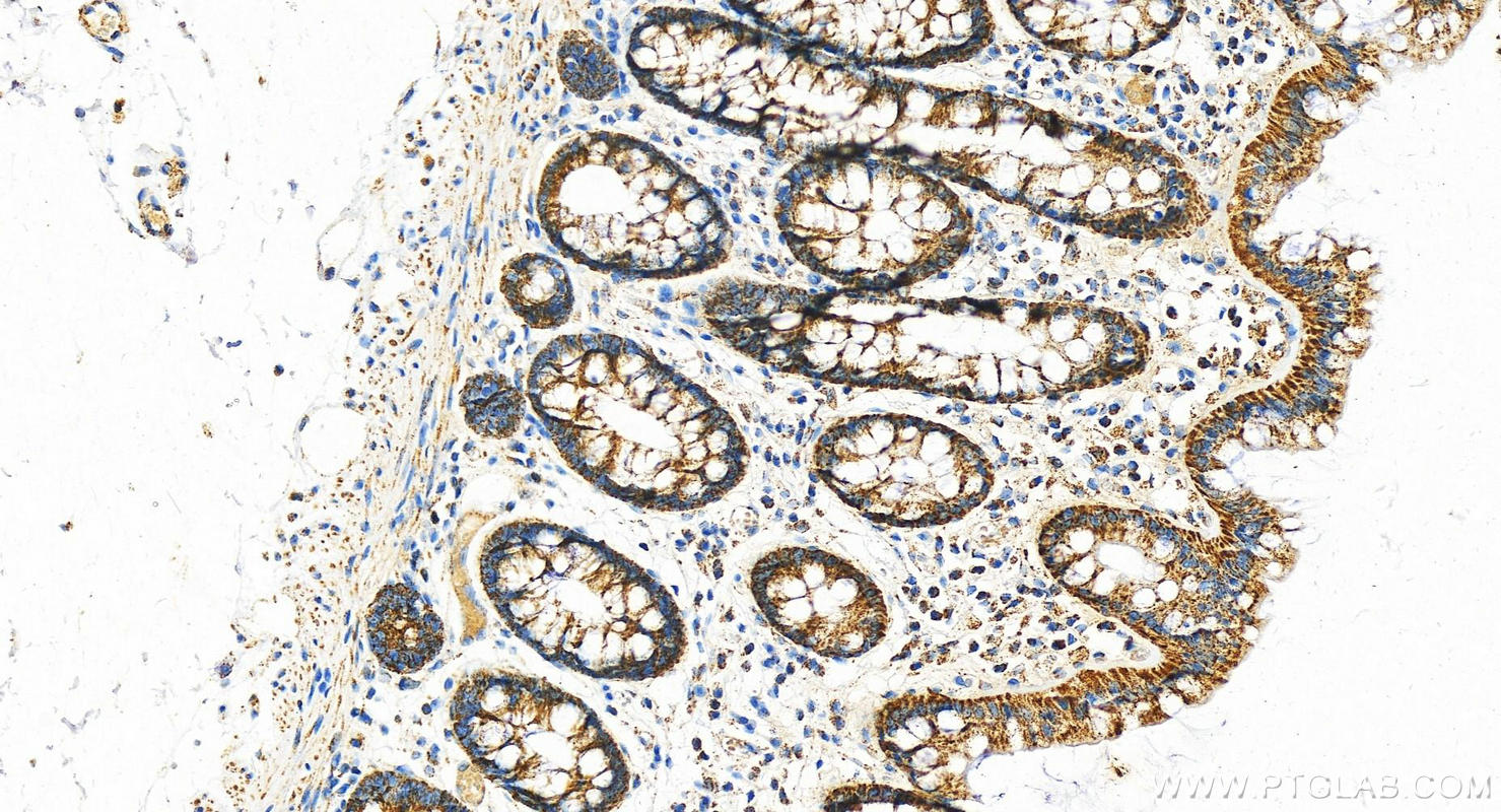 Immunohistochemistry (IHC) staining of human colon tissue using UQCRC1 Polyclonal antibody (21705-1-AP)