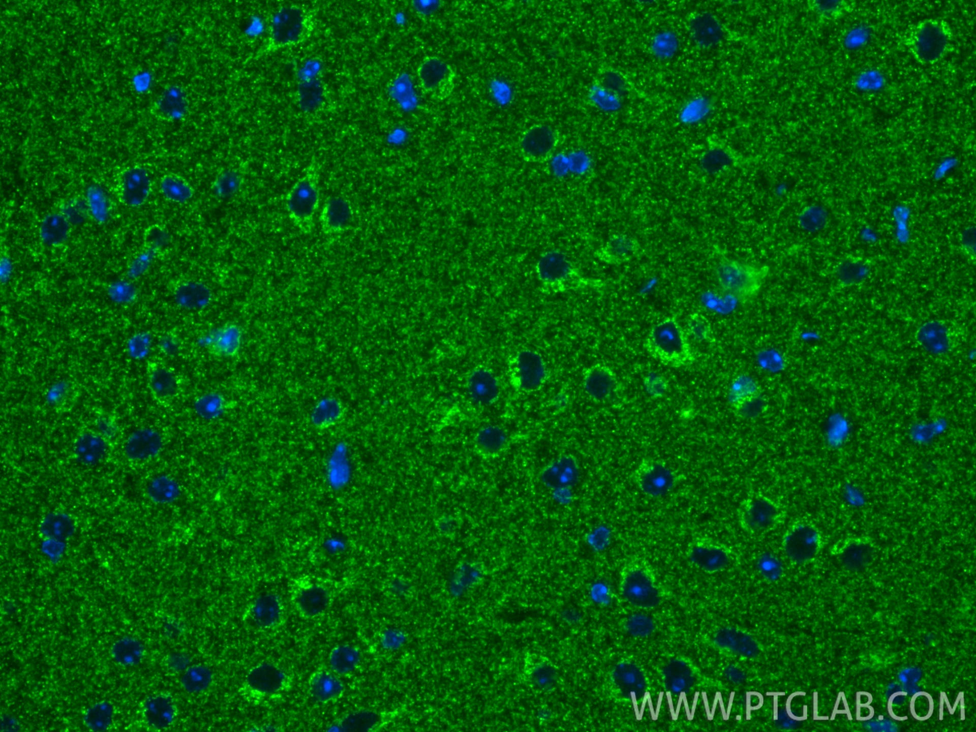 Immunofluorescence (IF) / fluorescent staining of mouse brain tissue using UQCRC1 Monoclonal antibody (67888-1-Ig)