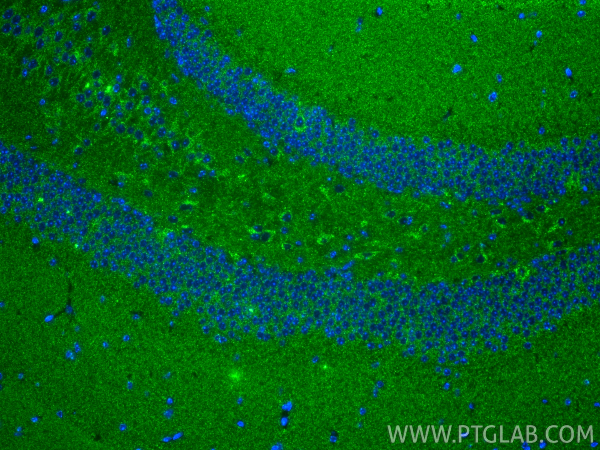 Immunofluorescence (IF) / fluorescent staining of mouse brain tissue using UQCRC1 Recombinant monoclonal antibody (83671-2-RR)