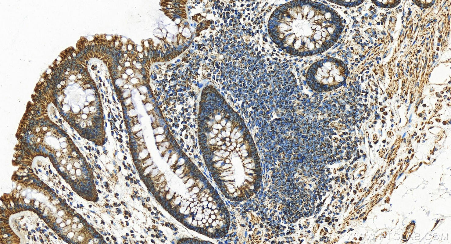 Immunohistochemistry (IHC) staining of human colon tissue using UQCRC2 Polyclonal antibody (14742-1-AP)