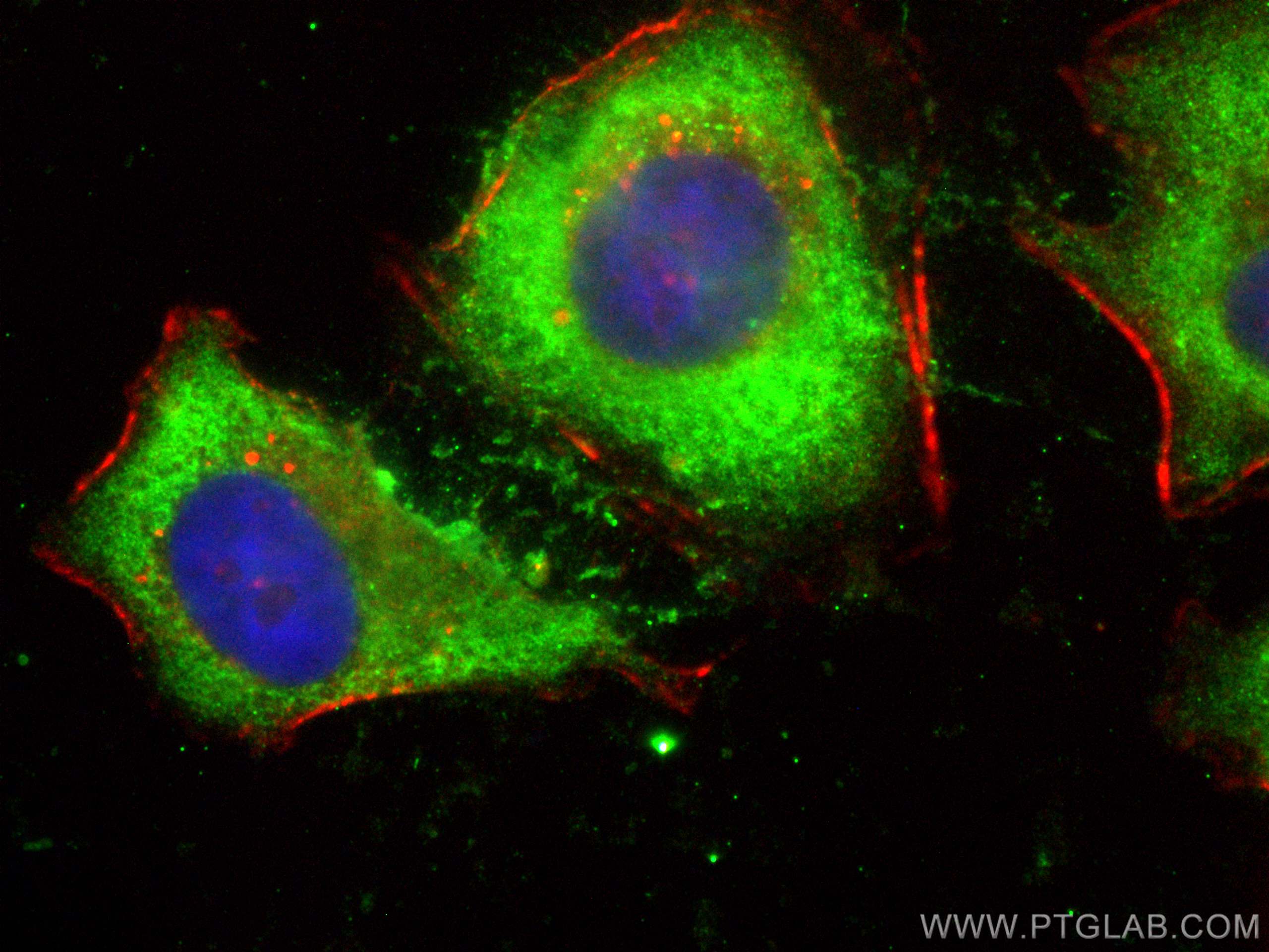 Immunofluorescence (IF) / fluorescent staining of HeLa cells using CoraLite® Plus 488-conjugated URG4 Polyclonal anti (CL488-11998)