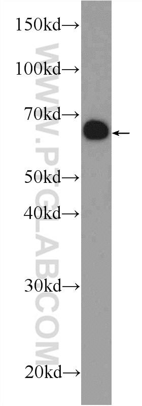 Western Blot (WB) analysis of mouse liver tissue using UROC1 Polyclonal antibody (25032-1-AP)