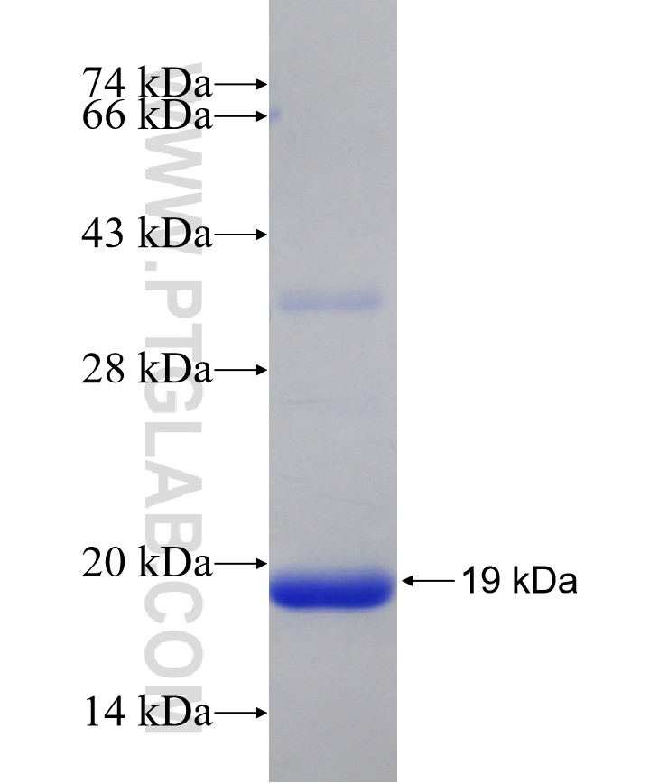 USH2A fusion protein Ag31270 SDS-PAGE