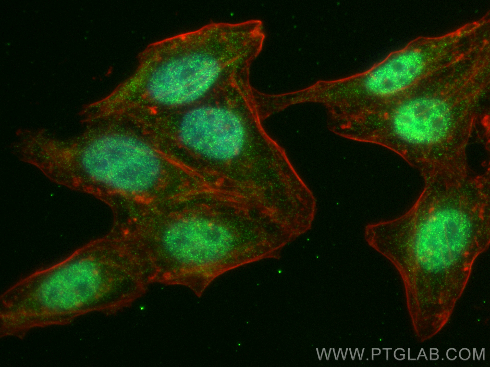 Immunofluorescence (IF) / fluorescent staining of HepG2 cells using USP10 Recombinant antibody (81435-2-RR)