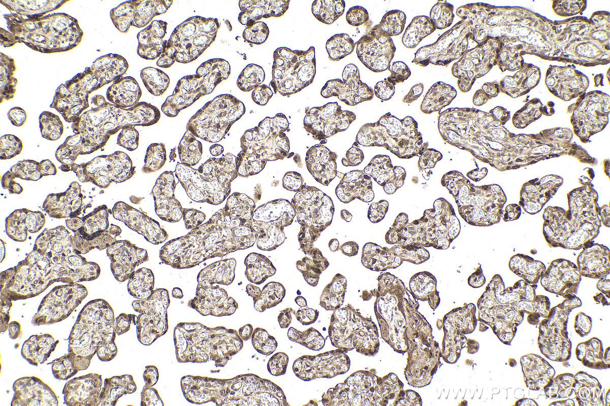 Immunohistochemistry (IHC) staining of human placenta tissue using USP15 Polyclonal antibody (14354-1-AP)