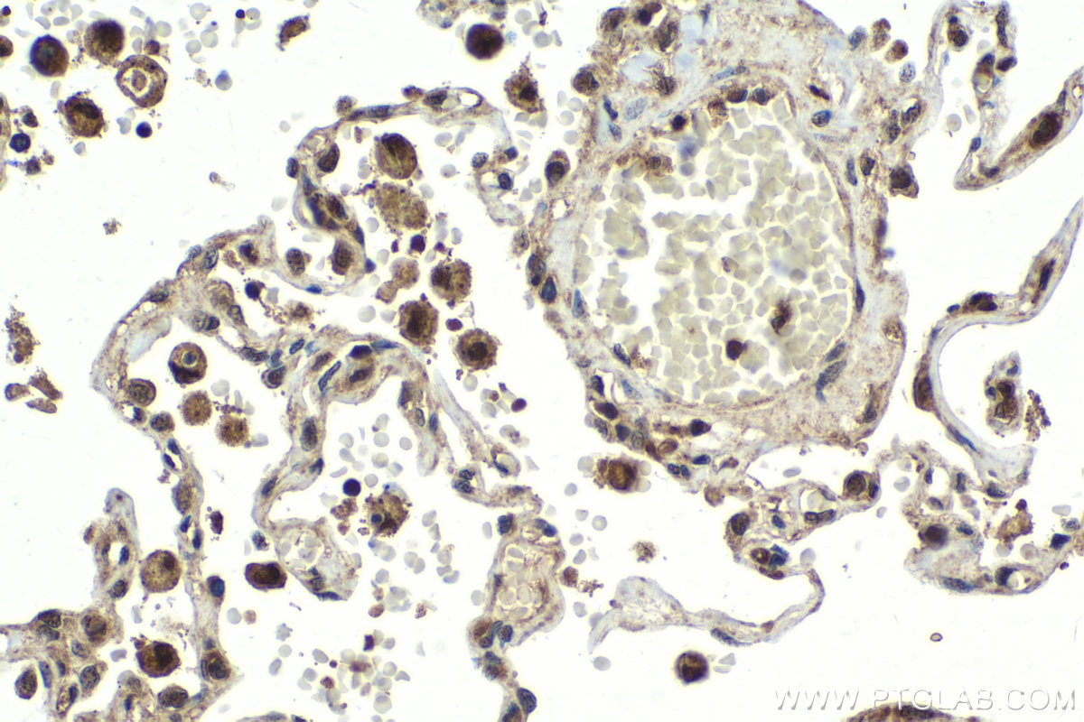 Immunohistochemistry (IHC) staining of human lung tissue using USP15 Polyclonal antibody (14354-1-AP)