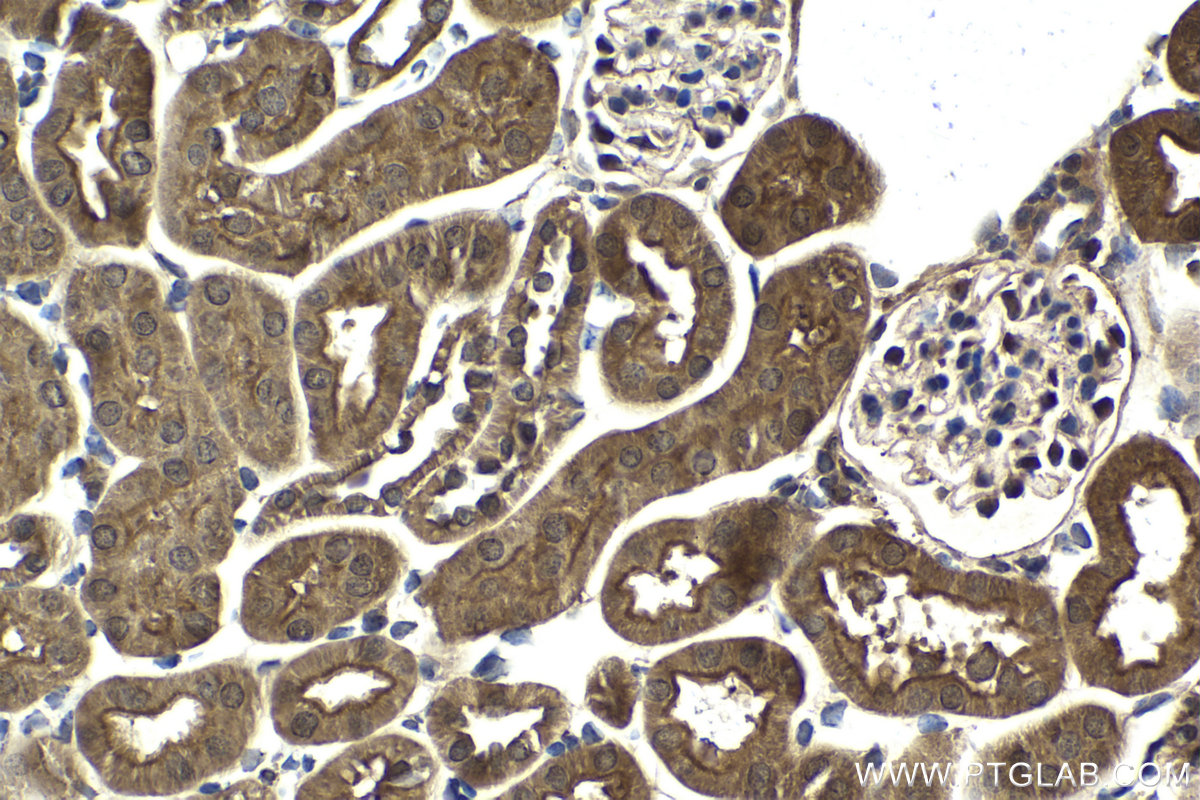 Immunohistochemistry (IHC) staining of mouse kidney tissue using USP15 Polyclonal antibody (14354-1-AP)