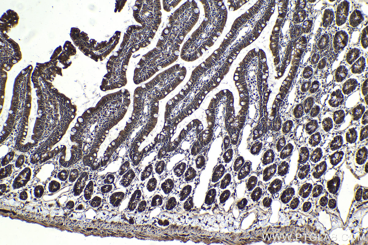 Immunohistochemistry (IHC) staining of rat small intestine tissue using USP15 Polyclonal antibody (14354-1-AP)