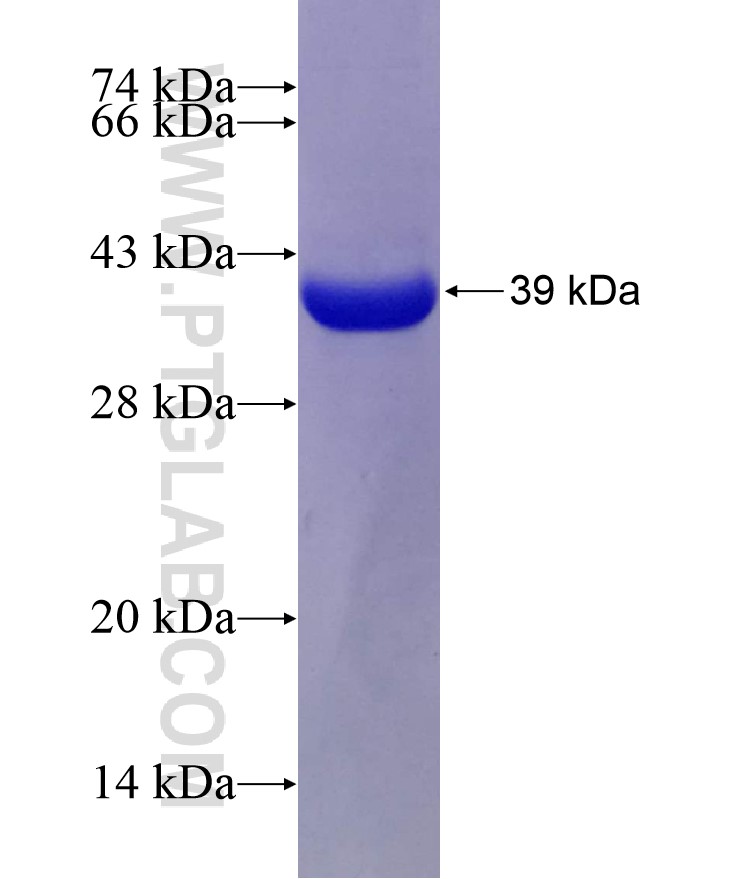 USP2 fusion protein Ag7741 SDS-PAGE