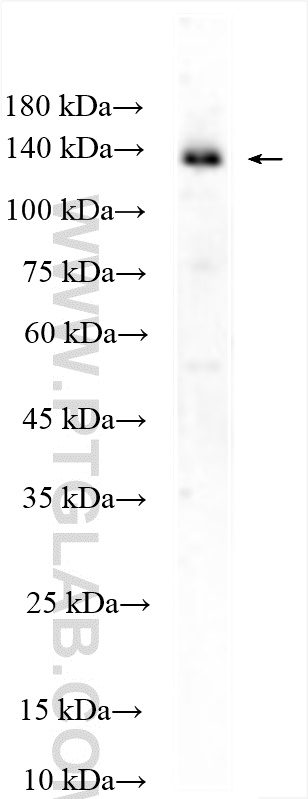 Western Blot (WB) analysis of HEK-293T cells using USP25 Polyclonal antibody (28817-1-AP)