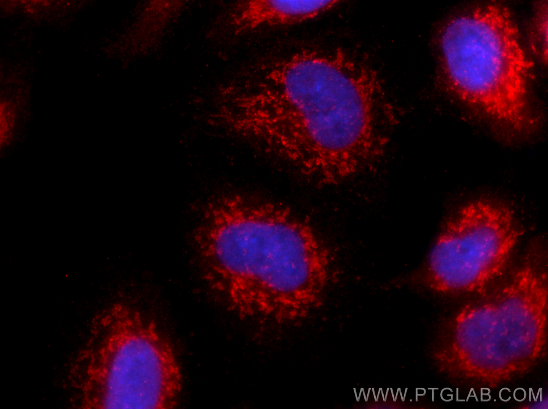 Immunofluorescence (IF) / fluorescent staining of A549 cells using USP30 Polyclonal antibody (15402-1-AP)