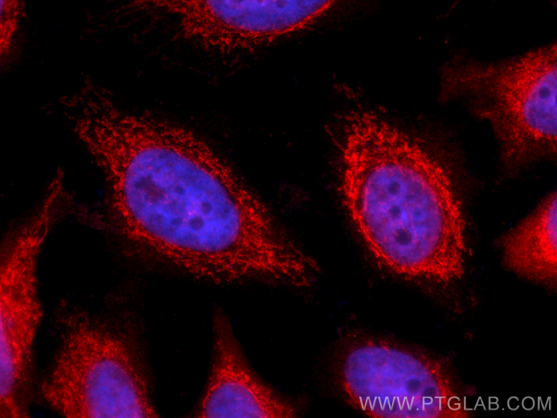 Immunofluorescence (IF) / fluorescent staining of hela cells using USP30 Polyclonal antibody (15402-1-AP)