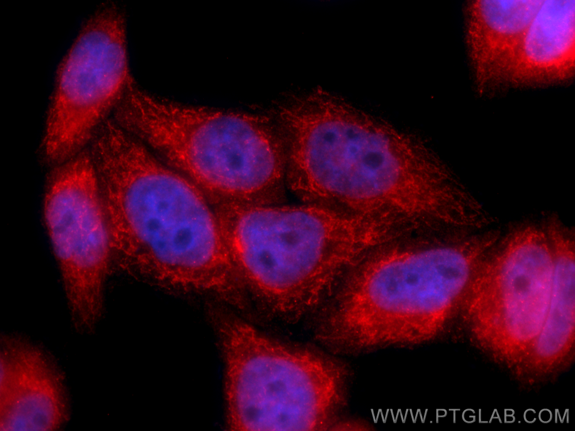 Immunofluorescence (IF) / fluorescent staining of HepG2 cells using USP30 Polyclonal antibody (15402-1-AP)